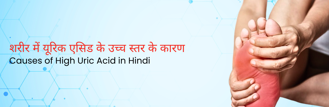 शरीर में यूरिक एसिड के उच्च स्तर के कारण